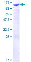 12.5% SDS-PAGE Stained with Coomassie Blue.